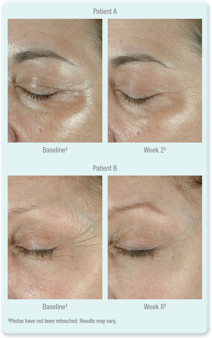 Obagi Skin Treatment #2 in Hendersen, KY